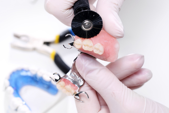 reparation protheses Faites réparer votre prothèse dentaire par un professionnel
