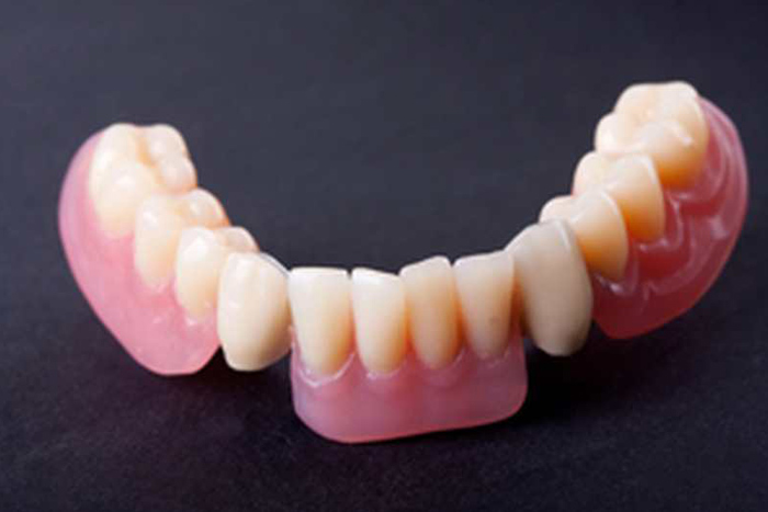 Proth&egrave;ses dentaires combin&eacute;es sur mesure