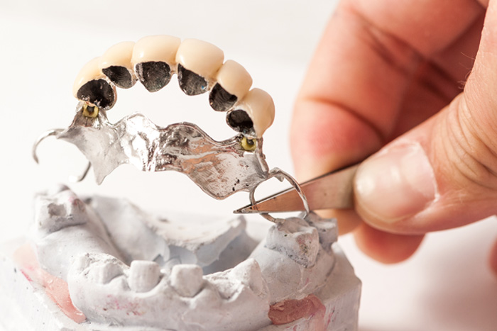 Faites r&eacute;parer votre proth&egrave;se dentaire par un professionnel